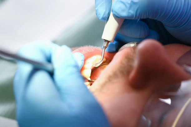 Best Chipped Tooth Repair Near Me  in Watts Mills, SC