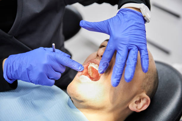 Emergency Gum Pain Relief in SC